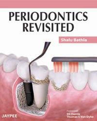 Periodontics Revisited by Shalu Bathla