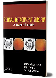 Retinal Detachment Surgery: A Practical Guide
